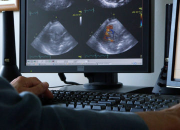 Ensuring Patient Access to High Quality Echocardiography Services in Ontario